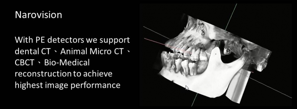 CBCT support